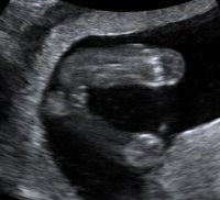 BABYBOND_10post.jpg