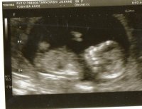 Baby girl scan 13-08-2012.jpg