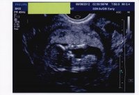 12wk3d ultrasound.jpg