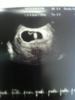 7 weeks (1).jpg