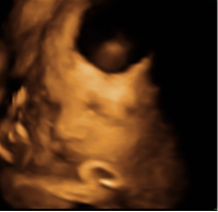 baby 3d.png