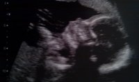 Little Bean 20 weeks4.jpg