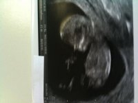 12 week scan.jpg