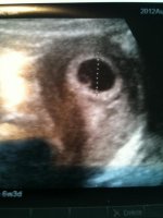 ultrasound.jpg