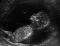 profile 3.png