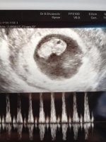 Bean Hearbeat 8wks4d.jpg