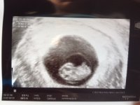 Bean 8wks4d.JPG