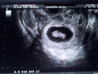 scan8wk6dayfront..jpg