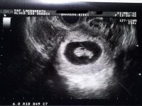 scan8wk6dayside.jpg