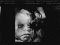 Ultrasound 8.24.jpg