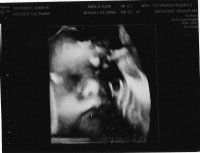 Ultrasound2 8.24.jpg
