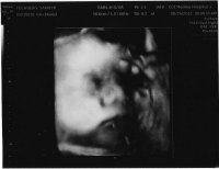 Ultrasound3 8.24.jpg