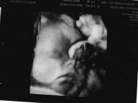 Ultrasound4 8.24.jpg