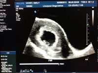 small file - 6 Week Dating Scan.jpg