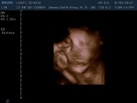 Liam 35W-4.jpg