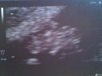 20120831_104431.jpg