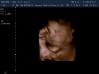 Liam 35W-5.jpg