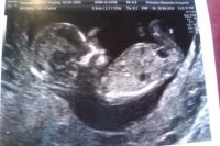 Baby scan.jpg