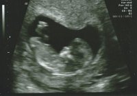 baby 11 wks 6 days.jpg