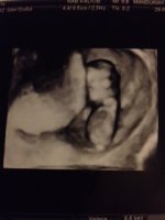12 weeks 3d.JPG