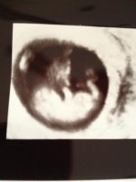 Bean 10wks4days.jpg