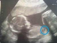 baby4jpeg.jpg