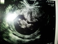 scan11wk1day.jpg