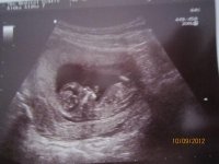 12wks scan100912b.jpg