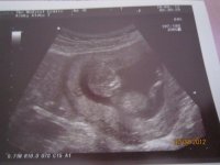 12wks scan100912a.jpg