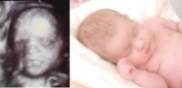 Kelsie 3d and newborn.jpg