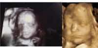 Kelsie 3d & Lanay 3D.jpg