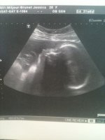 32 weeks.jpg