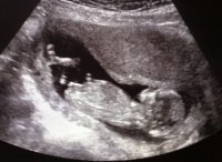 pic 13.jpg