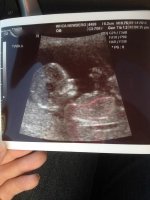 Baby A.jpg