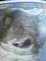 Baby 7 weeks 4 days sept 21 2012.jpg