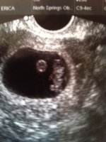 Ultrasound.jpg