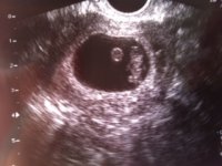 Ultrasound 3.jpg