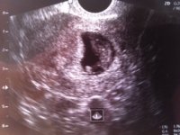 Ultrasound 1.jpg