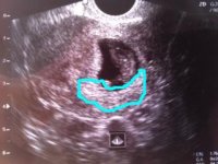 Ultrasound%201.jpg