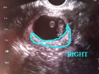 Ultrasound%203.jpg