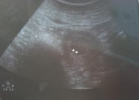 new pic-6week.jpg