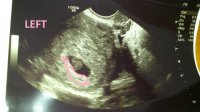 Baby3-1.jpg