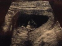 baby.jpg
