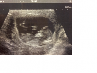 Baby No 2 again!.png