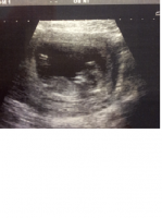 Baby No 2.png