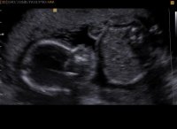 baby.jpg