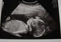 Weston 19 wk scan (2) (800x554).jpg