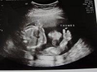 Weston 19 wk scan (1) (800x595).jpg