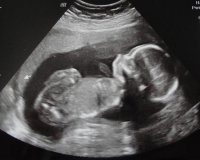 Weston 19 wk scan (6) (800x640).jpg