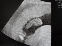 Weston 19 wk scan (8) (800x600).jpg